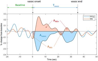 Identifying Elevated Risk for Future Pain Crises in Sickle-Cell Disease Using Photoplethysmogram Patterns Measured During Sleep: A Machine Learning Approach